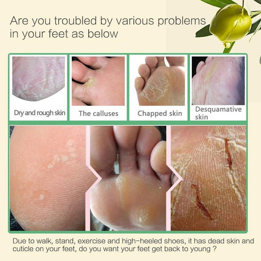 Aloe Vera Exfoliating Foot Mask for Peeling, Pedicure, and Heel Care