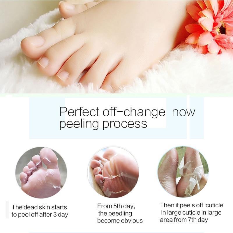 Load image into Gallery viewer, Aloe Vera Exfoliating Foot Mask for Peeling, Pedicure, and Heel Care
